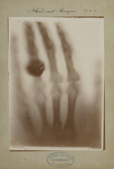 Foto_van_de_skelethand_van_Bertha_Roentgen_een_van_de_eerste_en_meest_bekende_X_ray_afbeeldingen_1895_Collectie_Teylers_